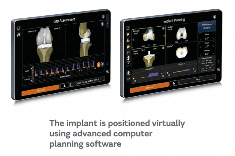 Advanced computer planning software